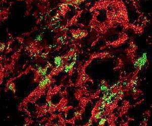 Lungs infected with plague bacteria also become playgrounds for other microbes