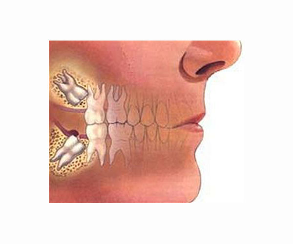 Marine Corps corporal gets 3D-printed teeth with jaw reconstruction