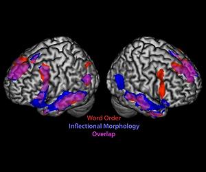 Sign Language Study Shows Multiple Brain Regions Wired For Language